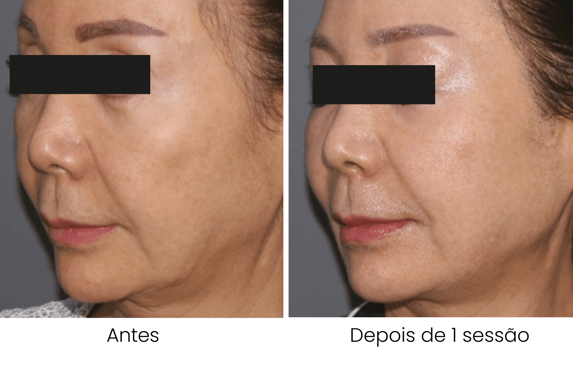 dentisy-antesedepois-01 dentisy-antesedepois-01