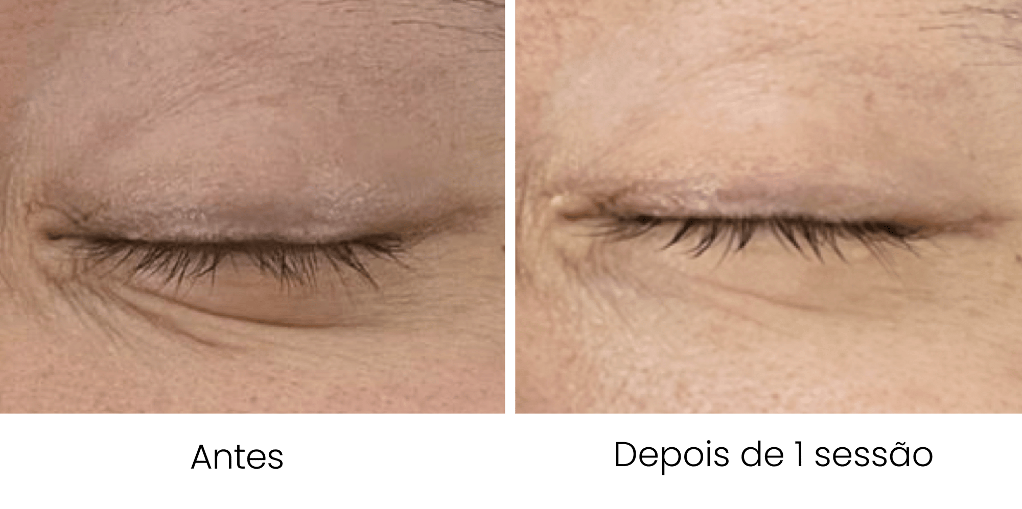 dentisy-antesedepois-02 dentisy-antesedepois-02