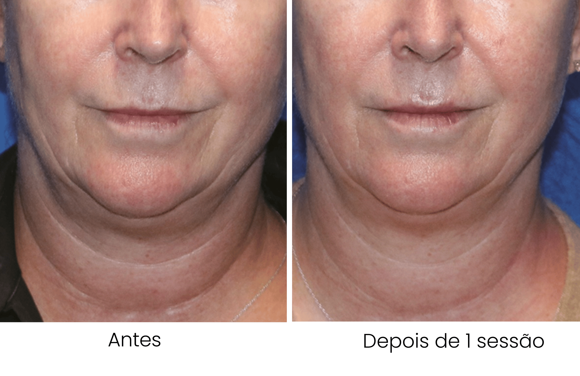 dentisy-antesedepois-03 dentisy-antesedepois-03