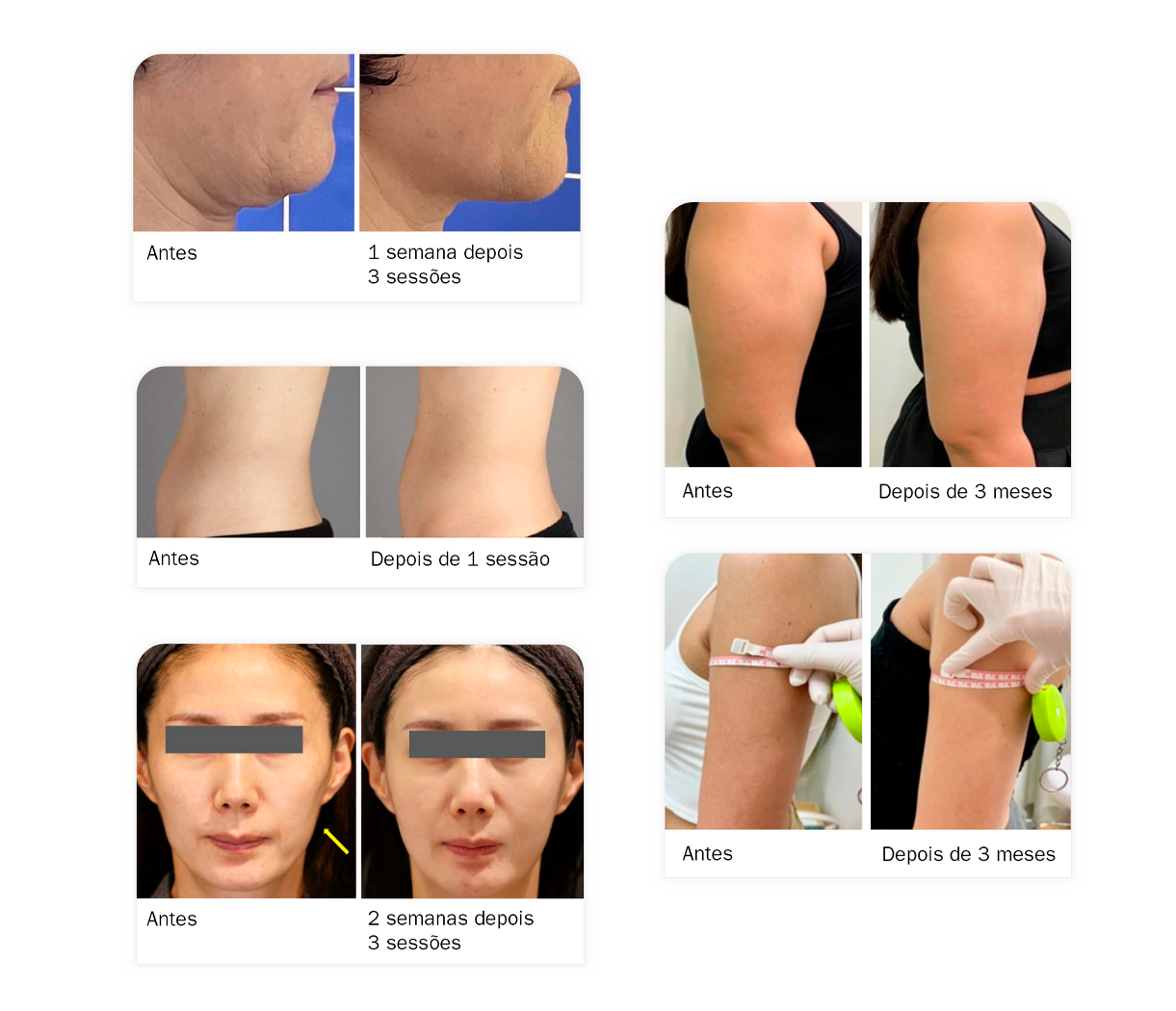 antesedepois-linearz-lp antesedepois-linearz-lp