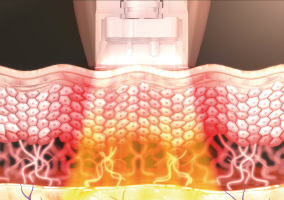 dentisy-camadas-01 dentisy-camadas-01