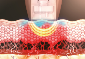 dentisy-camadas-02 dentisy-camadas-02